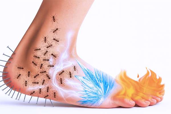 Lanss pain scale - neuropathic pain