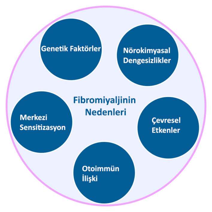 Fibromiyaljinin nedenleri